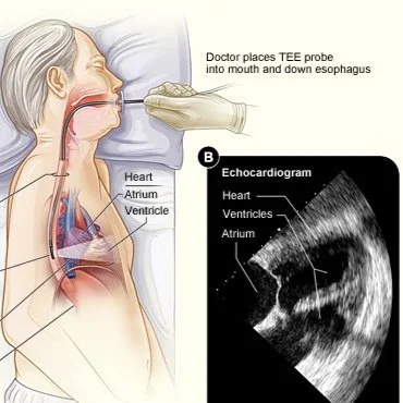 第41回　経食道エコー講習会　TEE Seminar YouTube